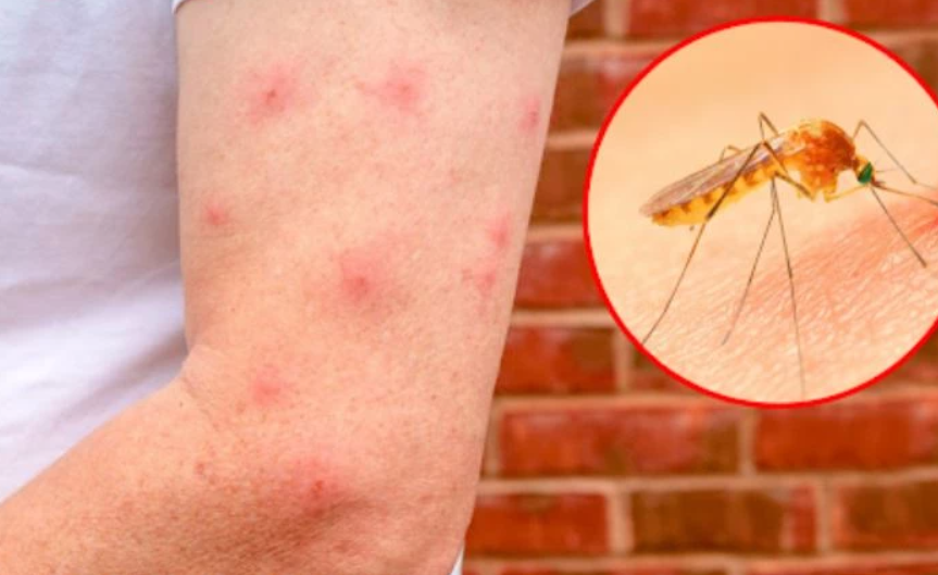 Phun Thuốc Muỗi Đà Lạt – Chủ Động Kiểm Soát Muỗi Trước Khi Chúng Sinh Sôi